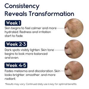 Bosman OEM Aloe Vera kem cho nám điều trị tuổi tại chỗ Remover da đổi màu sau tì vết vết sẹo điểm mặt cơ thể - Product Image 2