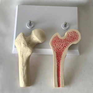 Modello di insegnamento medico di patologia del femore e della colonna vertebrale modello di osteoporosi di vendita a caldo - Product Image 5