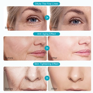 FATAZEN Crème Essence Anti-Rides Lisse Hydratant Ridules Hydratant Vente en Gros OEM Diminue les Rides Crème Visage - Product Image 5