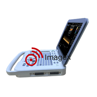 Machine à ultrasons Doppler couleur pour ordinateur portable portable pour usage humain et vétérinaire