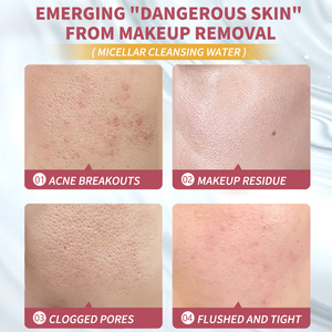 UUKKG RTS Nuovi Arrivi <span class=keywords><strong>Acqua</strong></span> Micellare 400ml Naturale Delicata per la Pulizia <span class=keywords><strong>di</strong></span> <span class=keywords><strong>Occhi</strong></span>, Labbra e Viso, <span class=keywords><strong>Struccante</strong></span> alla Rosa - Product Image 6