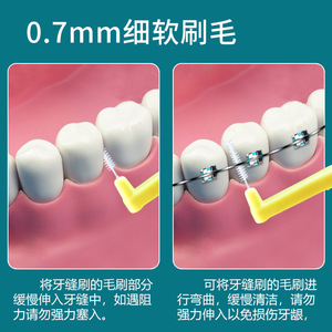Cepillo Interdental en Forma de L con Cerdas de Acero Inoxidable y Mango de Plástico para Cuidado Bucal de Uso General, 10 Piezas por Bolsa - Product Image 5