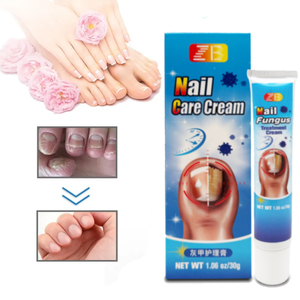 Crema ZB 30g per Micosi delle Unghie, Riparazione e Cura dei Piedi, Rimozione Funghi delle Unghie dei Piedi, Unguento per Onicomicosi - Product Image 2