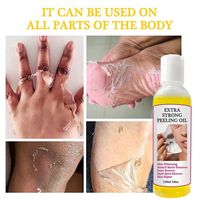 Huile exfoliante jaune extra forte pour éclaircir les coudes, les genoux, les mains, la mélanine, blanchir la peau foncée, huile exfoliante forte pour le visage