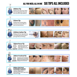 เครื่องเลเซอร์ลบ<span class=keywords><strong>รอย</strong></span><span class=keywords><strong>สัก</strong></span> Kes 110V/220V 50-60Hz Q ลบ<span class=keywords><strong>รอย</strong></span><span class=keywords><strong>สัก</strong></span>เลเซอร์กำจัดรอยสัก532nm เลเซอร์สำหรับร้านเสริมสวย - Product Image 6