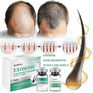 Sérum réparateur du cuir chevelu Exo Some en gros, 5 ml, extrait de lait, kit de soin des cheveux pour hommes - Product Image 1