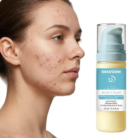 Crème Visage à l'Acide Salicylique pour Peaux à Tendance Acnéique, Anti-Imperfections, Anti-Marques de Boutons, Anti-Taches Brunes, Resserre les Pores et Contrôle le Sébum