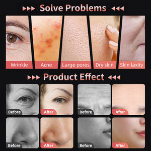 עור הפנים מיצוק תרסיס לחות חמצן מיקרוקריסטלי רפואי לחות תרסיס מיצוק עור פנים - Product Image 4