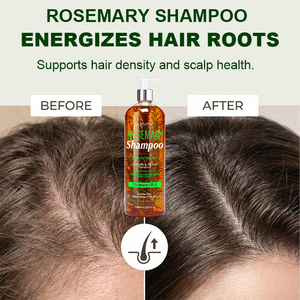 <span class=keywords><strong>Shampoo</strong></span> al Rosmarino Delicato per Pulizia Profonda, Nutrimento, Riparazione Cuticole, Lenitivo per il Cuoio Capelluto, Anti-Caduta - Product Image 5