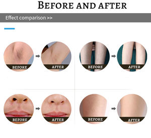 Appareil <span class=keywords><strong>laser</strong></span> de physiothérapie pour le traitement des douleurs mineures du cou et des épaules - Product Image 5