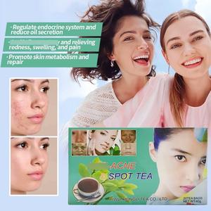 Té Herbal de Belleza para el Mercado Africano, Aclarante de Piel, Antienvejecimiento y Anti-Manchas, Venta al Por Mayor de Fábrica - Product Image 3