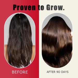 Tabletas para el Crecimiento del Cabello al por Mayor OEM, Ingredientes Herbales Naturales, Tratamiento Interno para el Cabello y Prevención del Retroceso de la Línea del Cabello, Retrasa la Caída - Product Image 3