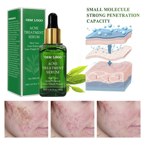OEM Private label Trattamento di <span class=keywords><strong>Acne</strong></span> Siero, Olio di <span class=keywords><strong>Tea</strong></span> <span class=keywords><strong>Tree</strong></span> Siero per la Compensazione <span class=keywords><strong>Acne</strong></span> Severa, Breakout, rimozione Brufolo e la Riparazione Della Pelle - Product Image 5