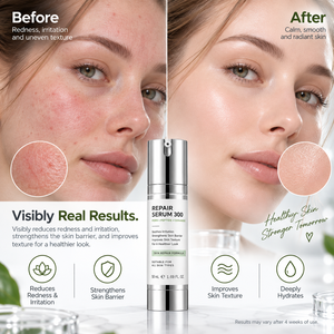 Suero Coreano Personalizado OEM para el Cuidado de la Piel con Centella Asiática, Ácido Hialurónico y Extracto de Propóleo, Reparador, Calmante y Antialérgico - Product Image 4