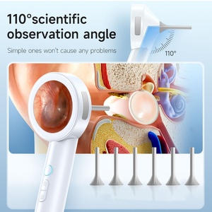 <span class=keywords><strong>Appareil</strong></span> d'inspection auriculaire intelligent PAKISS, caméra HD 1080P, écran, vérificateur d'<span class=keywords><strong>oreilles</strong></span> intelligent pour usage domestique, compatible Wi-Fi, batterie rechargeable - Product Image 3