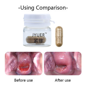 Donne yoni pop femminili probiotici <span class=keywords><strong>Capsule</strong></span> in polvere per la pulizia della vagina pillole per il rafforzamento vaginale della capsula morbida - Product Image 4