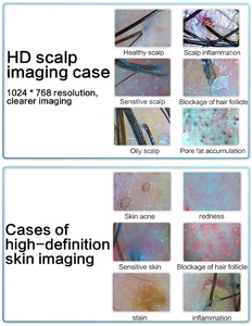 เครื่องวิเคราะห์รูขุมขนและหนังศีรษะ HD 2025เครื่องวิเคราะห์เส้นผมเครื่องวิเคราะห์หนังศีรษะสำหรับสปาผม - Product Image 6