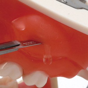 Modèle dentaire <span class=keywords><strong>maxillaire</strong></span> bilatéral de dents sensibles - Product Image 4