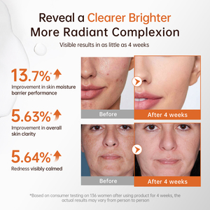 Suero Facial Blanqueador BOLI de 30 ml con Logotipo Personalizado, Cuidado de la Piel, Antimanchas, Iluminador, Ácido Kójico, Hamamelis, Niacinamida - Product Image 6