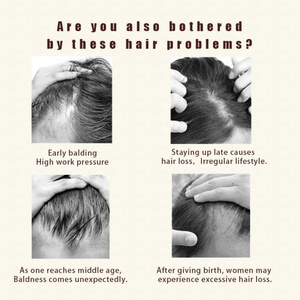 Nouveaux produits de soin du cuir chevelu : peigne lisseur massant, brosses capillaires, thérapie par lumière LED bleue, rouge et rose pour la croissance des cheveux - Product Image 5