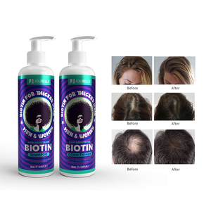 Ensemble de shampooing bouclé pour femmes noires, étiquette privée, biotine biologique, <span class=keywords><strong>Anti</strong></span>-<span class=keywords><strong>chute</strong></span>, croissance des <span class=keywords><strong>cheveux</strong></span>, shampoing et après-shampoing - Product Image 2