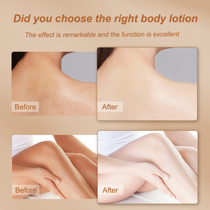 Productos <span class=keywords><strong>de</strong></span> belleza <span class=keywords><strong>cuida</strong></span> <span class=keywords><strong>tu</strong></span> piel y crema para el cuidado blanquea <span class=keywords><strong>tu</strong></span> piel la mejor loción corporal - Product Image 5