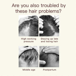 Brosse de massage du cuir chevelu électrique KSKIN EMS - Acier inoxydable, technologie bio haute fréquence, compatible voiture, micro-courant pour la croissance des cheveux - Product Image 5