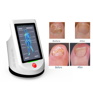 Láser de Diodo Berylas de 810nm y 980nm, Multi-Longitud de Onda, 15W, Clase II, <span class=keywords><strong>para</strong></span> el Tratamiento de <span class=keywords><strong>Hongos</strong></span> <span class=keywords><strong>en</strong></span> <span class=keywords><strong>los</strong></span> <span class=keywords><strong>Pies</strong></span> - Product Image 3