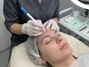 Fine Tip Medical Marker Cosmetic Procedures - Product Image 1