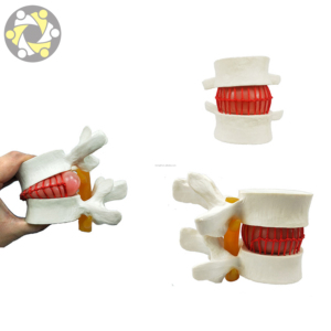 Sistema Esquelético D1101: Modelo de Demostración para la Enseñanza de Lesiones de la Columna Lumbar en <span class=keywords><strong>el</strong></span> <span class=keywords><strong>Cuerpo</strong></span> <span class=keywords><strong>Humano</strong></span> - Product Image 2