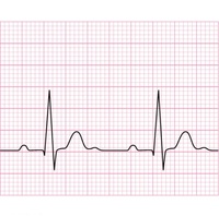 Papier thermique ECG Nihon Kohden 210 110x140 Z Fold Examen EKG ECG