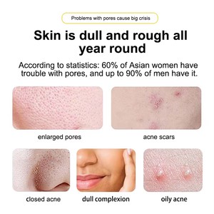 เซรั่มบำรุงผิว<span class=keywords><strong>หน้า</strong></span>อะโลเวร่าขั้นสูง: <span class=keywords><strong>รักษา</strong></span><span class=keywords><strong>สิว</strong></span>และริ้วรอย ช่วยกระตุ้นการไหลเวียนของน้ำในรูขุมขน ปรับสีผิวให้สม่ำเสมอ ปราศจากน้ำมัน สูตรต่อต้านริ้วรอยและเพิ่มความกระจ่างใส - Product Image 5