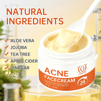 Crème réparatrice Calantha pour les taches brunes et l'acné avec AHA et Niacinamide - Hydratant éclaircissant pour tous types de peau