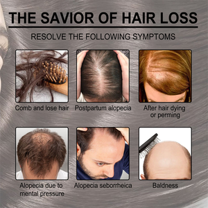 High Quality Oem Herbal Natural Ginseng Anti-loss Instant Promote <strong>Hair</strong> Growth <strong>Korean</strong> Ginseng Blossom <strong>Shampoo</strong> <strong>for</strong> Women and <strong>Men</strong> - Product Image 2