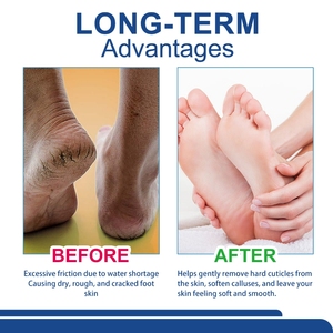 JMFREE Krim Pelembab Kaki Grosir Perawatan Kaki Menutrisi Anti Kering Tumit Pecah-pecah Perbaikan Kaki Blam Urea Krim Kaki Anti Kering Bentuk Stick - Product Image 5