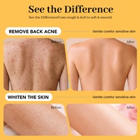 Gommage au Curcuma OEM - Gommage Corporel Éclaircissant Naturel, Exfoliant pour Genoux et Coudes Sombres, Anti-Cellulite Marque Privée