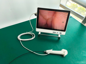 Disposable Flexible hoscopy Customization 2.8mm 3.8mm New Portable hoscope with HDMI Type C - Product Image 6