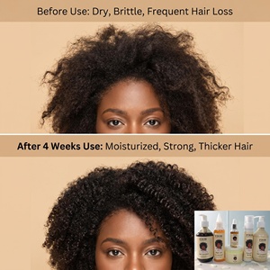 Olio per la Crescita dei Capelli Chebe Africano Puro, Formula Tradizionale, Riduce la Rottura, Trattamento Nutriente per il Cuoio Capelluto, per Capelli Neri, OEM Accettato - Product Image 5