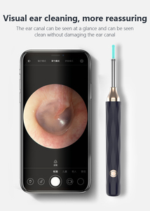 Wireless Wifi Electric <strong>Ear</strong> Pick Tool Earwax Removal Kit 1080P <strong>Ear</strong> Cleaner Otoscope With Camera Light <strong>Ear</strong> Wax Removal - Product Image 2
