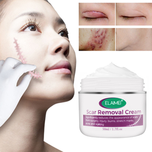 Crème pour le visage ELAIMEI contre les brûlures et les cicatrices, logo personnalisé, lissante, raffermissante, anti-vergetures, crème réparatrice pour toutes les cicatrices - Product Image 3