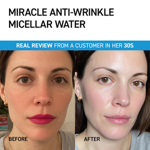 Eau Micellaire Hydratante IVOSKIN au Collagène – Soin Quotidien Visage Lissant, Éclat Moderne, Réparation Dermatologique Équilibrée - Product Image 2