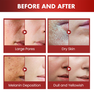 Crema de sangre de dragón blanqueadora para el cuidado facial OEM/ODM - Product Image 4