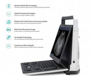 Ecocardiógrafo Sonoscape 15,6 pulgadas Sonoscape E1 E2 E2v Máquina de ultrasonido Doppler a color de alta resolución - Product Image 4