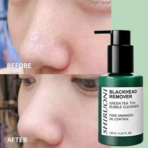 Limpiador de limpieza facial de espuma de espinillas de desintoxicación de té verde natural OEM ODM limpiador de poros de piel de acné seco diario aligeramiento - Product Image 5