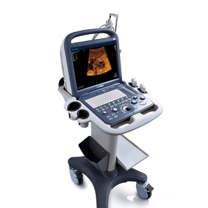 <span class=keywords><strong>Sonoscape</strong></span> <span class=keywords><strong>S2</strong></span> Portable <span class=keywords><strong>Sonoscape</strong></span> Usg Color Doppler Usg - Product Image 1