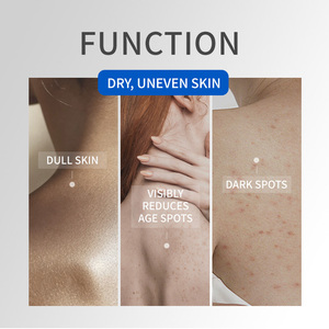 Crème <span class=keywords><strong>pour</strong></span> le corps éclaircissante à la niacinamide Icesea OEM, crème hydratante <span class=keywords><strong>anti</strong></span>-<span class=keywords><strong>taches</strong></span> avec vitamine C et beurre de karité - Product Image 3