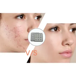 Private Label Top Grade Microneedling Acne Pimple Patch With Micro Needle Patches Healing Acne Spot Fast