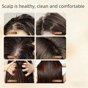 Shampoo all'Acqua di Riso con Ingredienti <span class=keywords><strong>Naturali</strong></span>, <span class=keywords><strong>Prodotti</strong></span> <span class=keywords><strong>per</strong></span> <span class=keywords><strong>Capelli</strong></span> Erboristici Anti-Crespo e Riparatori - Product Image 4