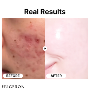 ERIGERON Nouvelle Arrivée Vente Chaude 50ml Sérum de Riz avec Niacinamide 10% + 87% Fabriqué en Corée Produit de Soins de la Peau Vente en Gros - Product Image 3