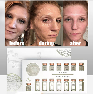 OEM mặt nâng làm săn chắc <span class=keywords><strong>Enzyme</strong></span> Peel mặt nạ khuôn mặt V hình nâng da sáng <span class=keywords><strong>Enzyme</strong></span> điều trị hexapeptide đông khô bột - Product Image 3